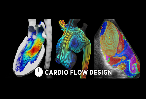株式会社Cardio Flow Design1